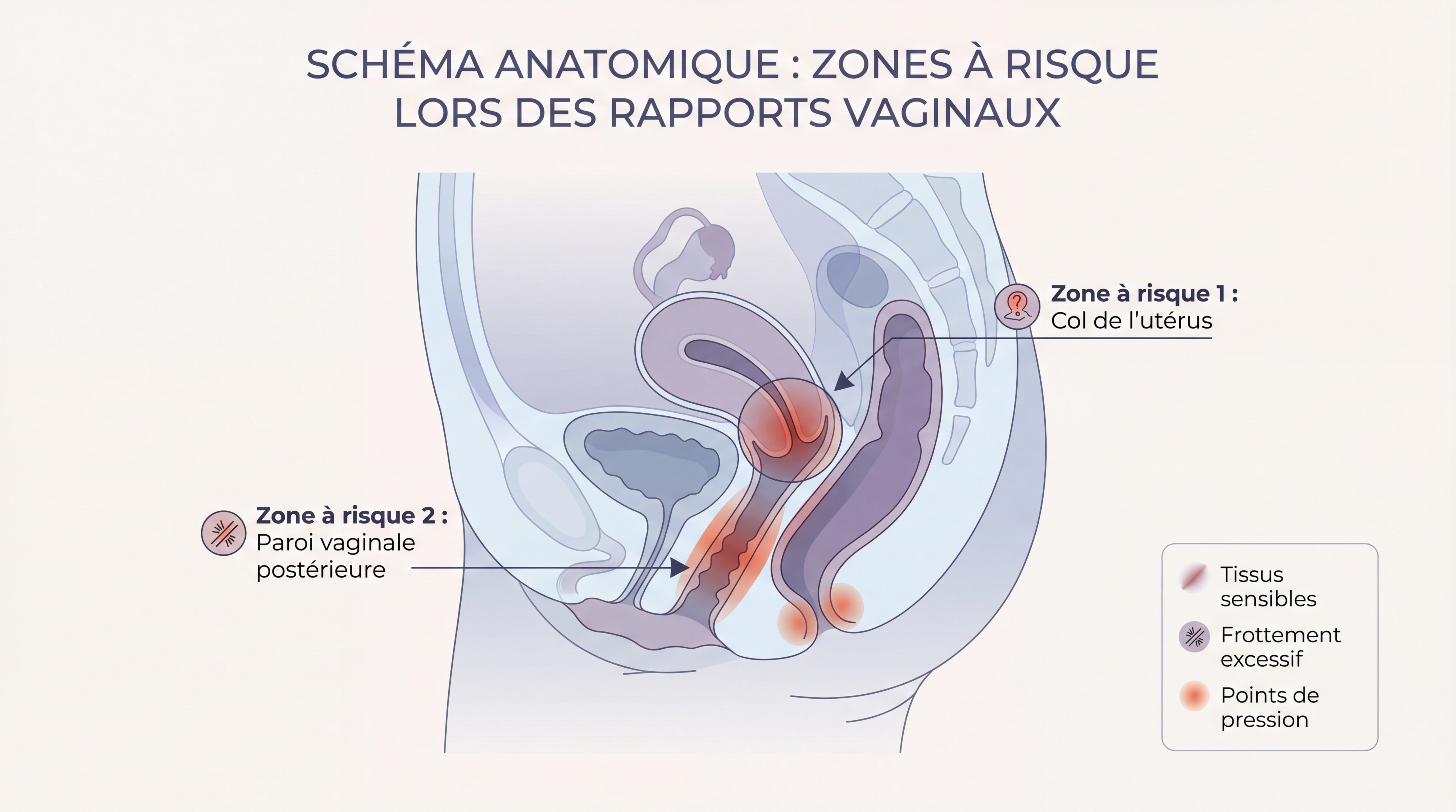Schéma anatomique illustrant les zones à risque lors des rapports vaginaux