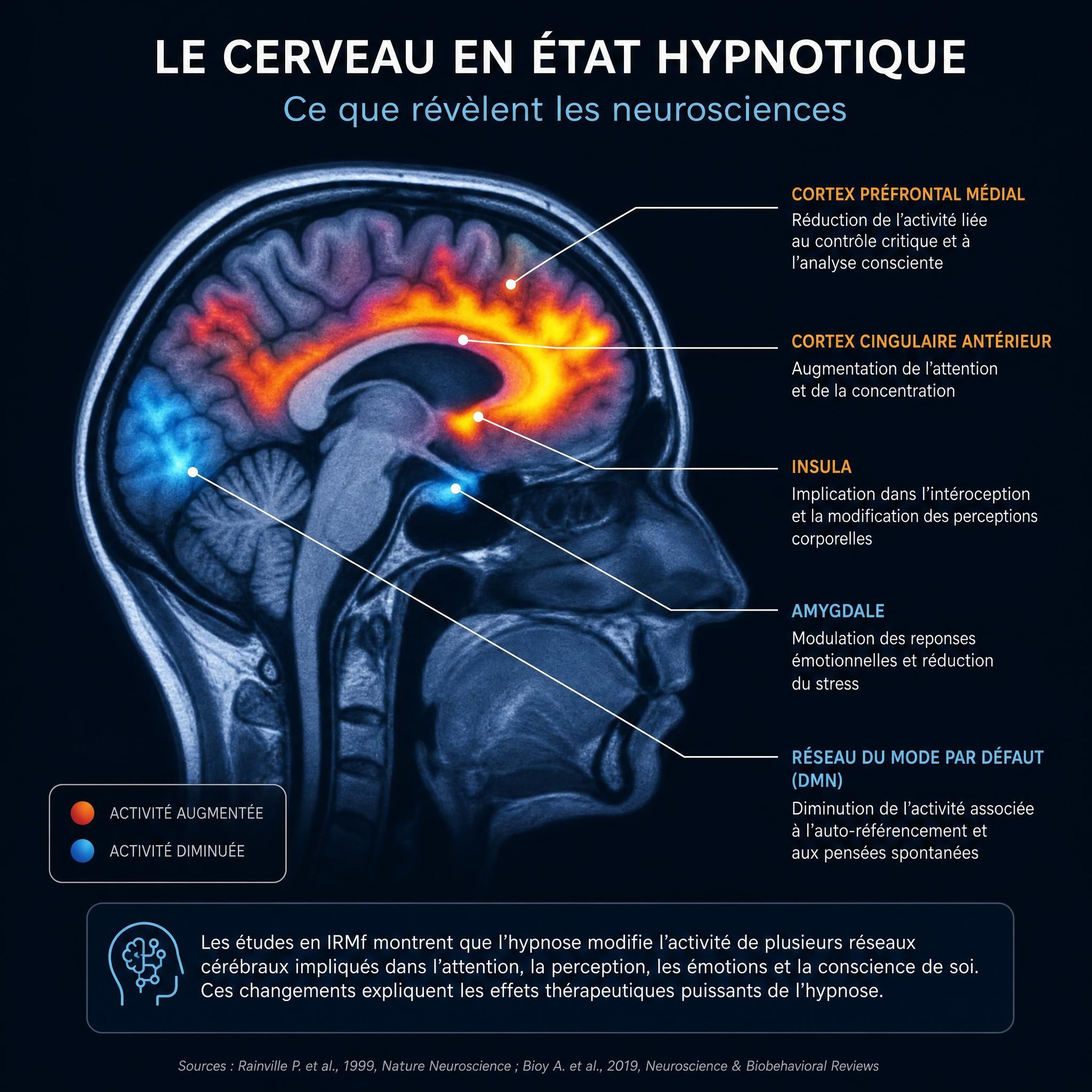Illustration cerveau humain en IRM fonctionnelle montrant les zones activées pendant l'état hypnotique, représentant les neurosciences de l'hypnose