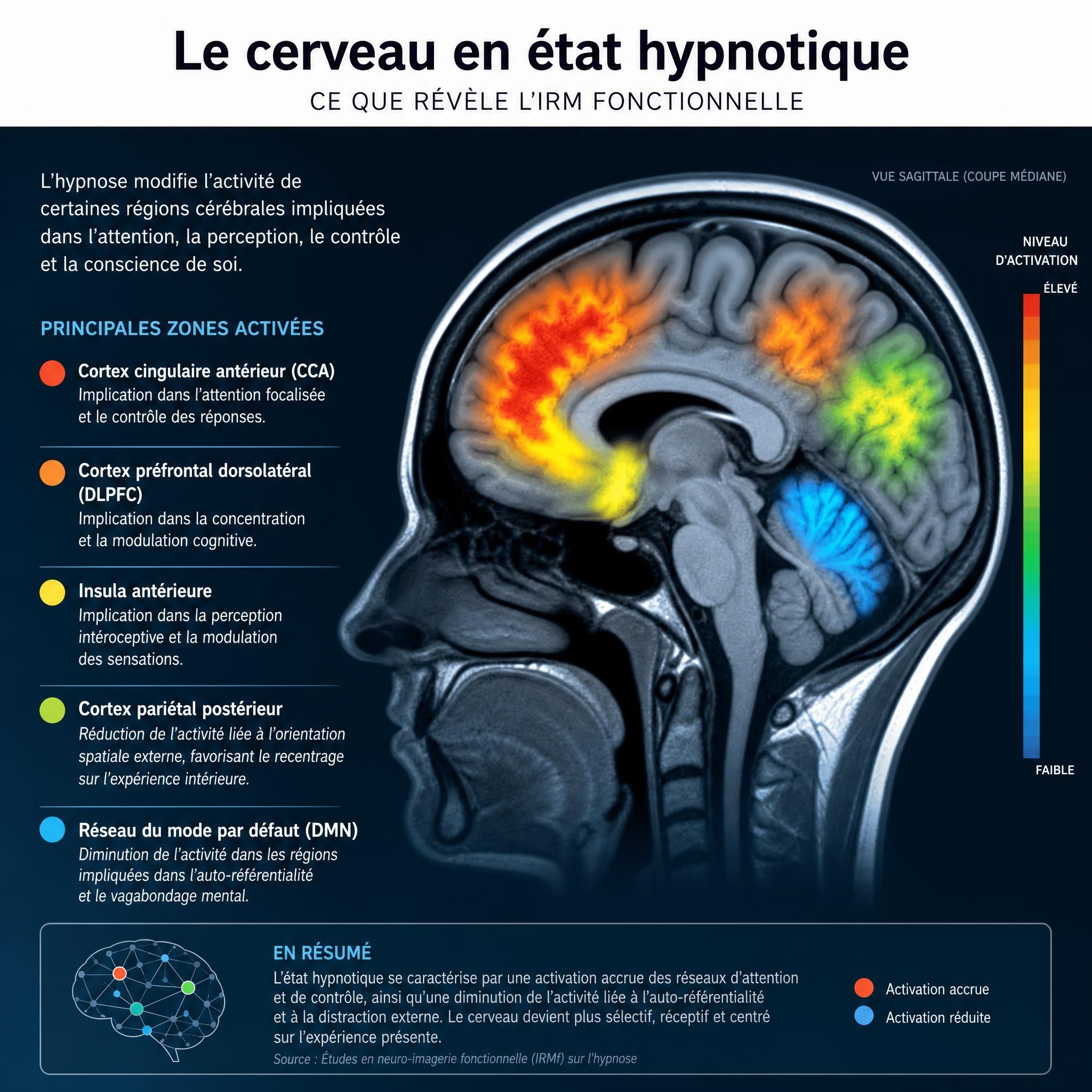 Cerveau humain en IRM fonctionnelle illustrant les zones activées pendant l'état hypnotique, infographie scientifique