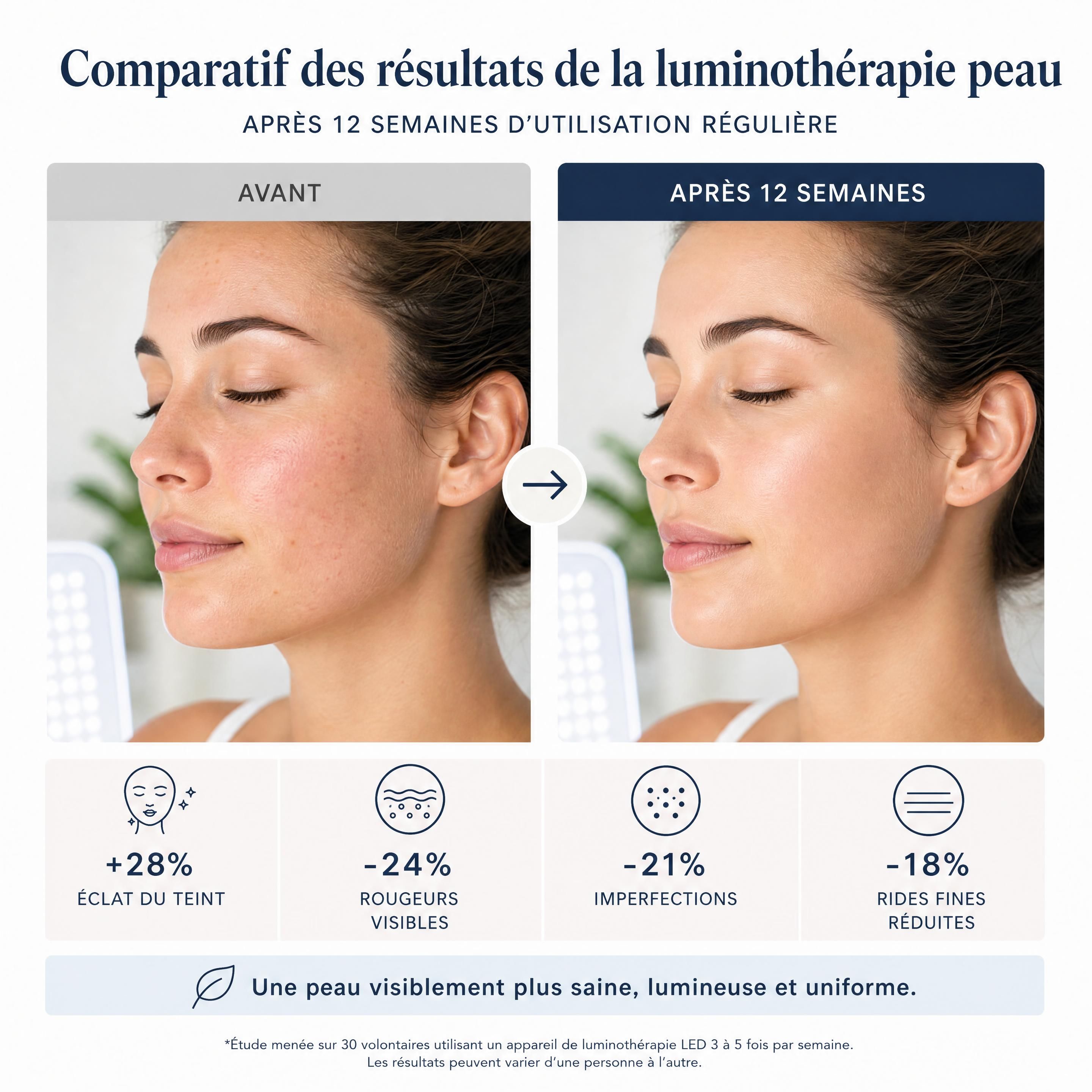 Comparatif des résultats de la luminothérapie peau avant et après 12 semaines d'utilisation régulière