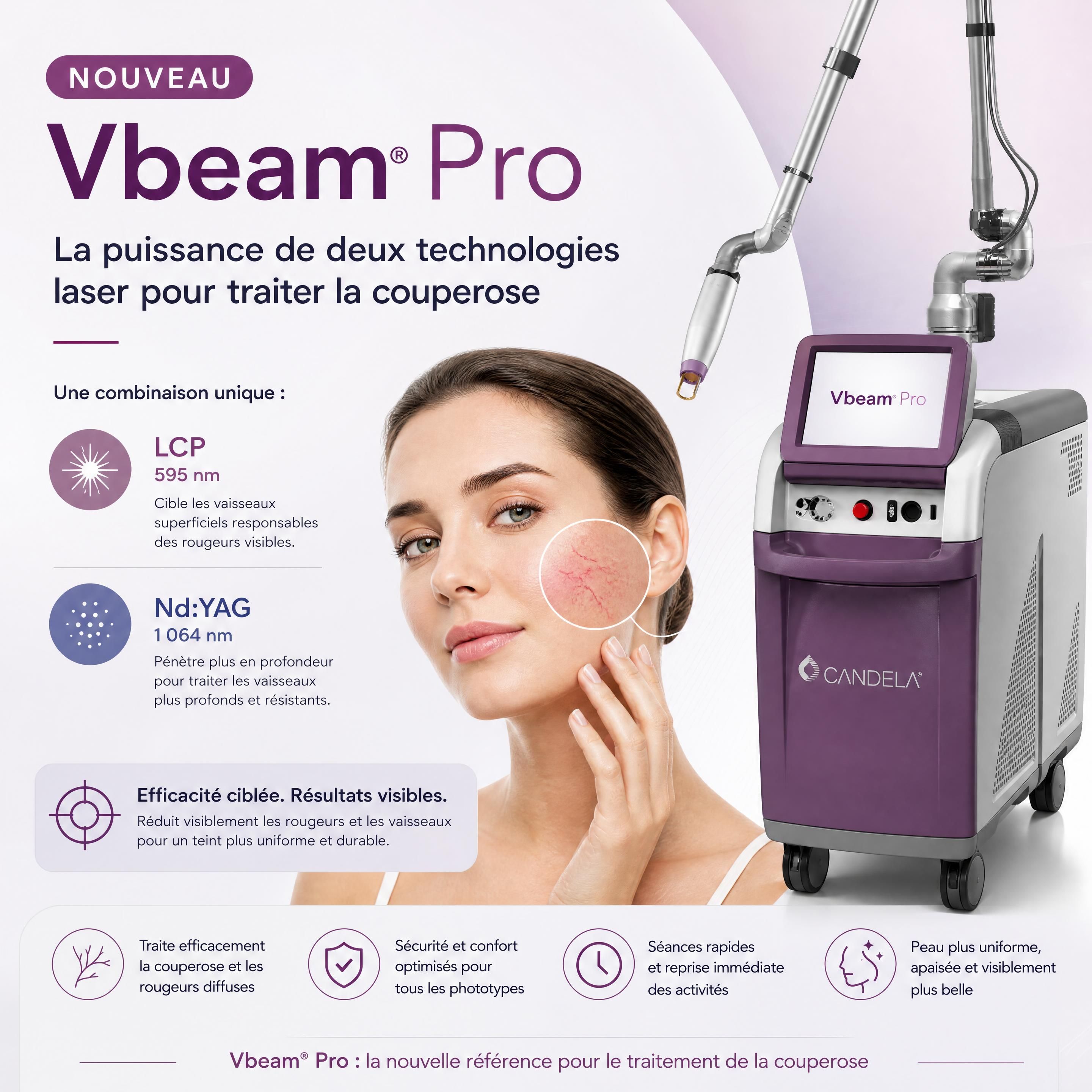 Illustration du nouveau laser Vbeam Pro combinant LCP et NdYAG pour traiter la couperose