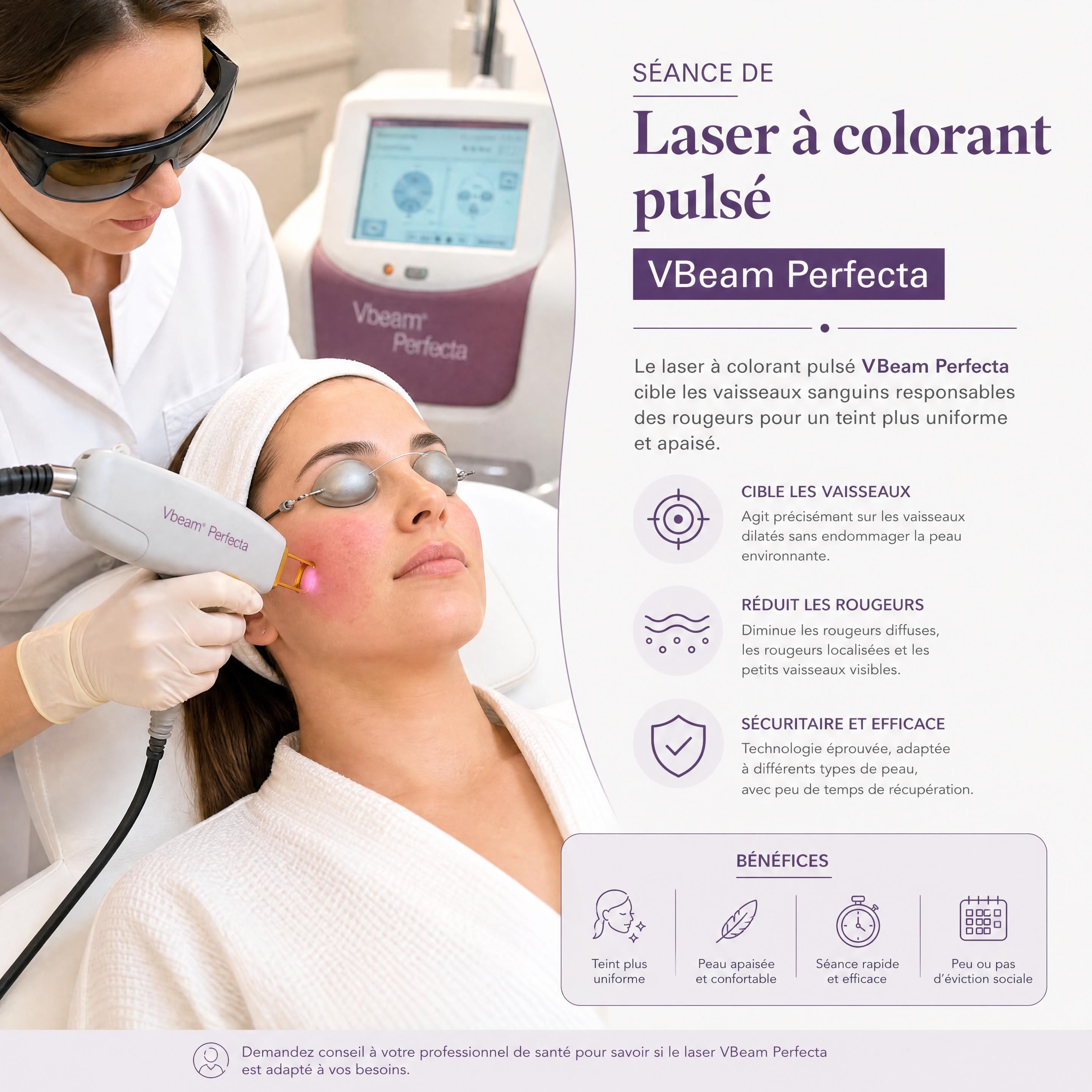 Séance de laser à colorant pulsé VBeam Perfecta sur les joues d'un patient